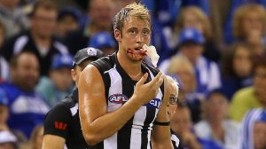 Ben Reid should play this week despite suffering sever cuts to his mouth.